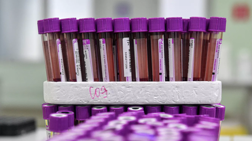 В Сахалинской области прокомментировали ситуацию с COVID-19