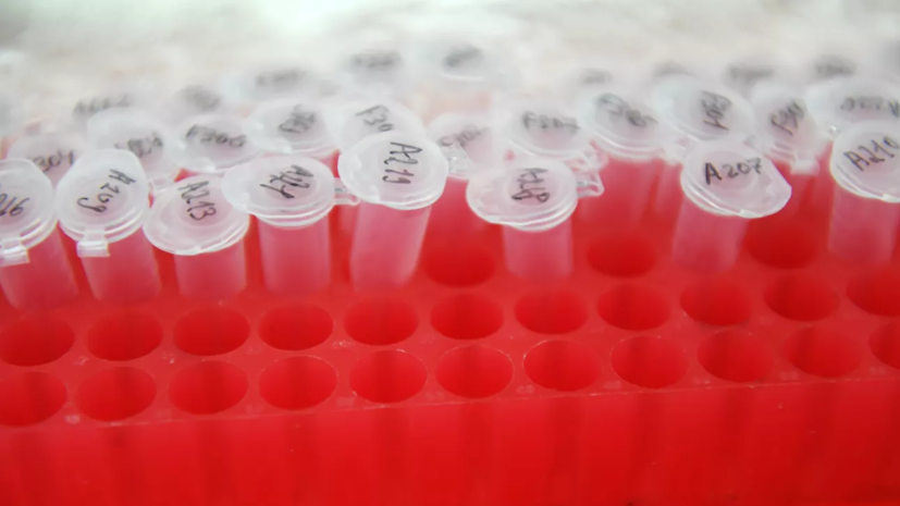 В Удмуртии по состоянию на 1 сентября выявлено 38 новых случаев COVID-19