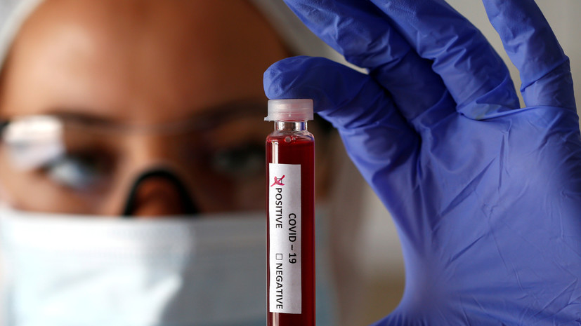 В Мурманской области выявлено 73 новых случая заболевания COVID-19