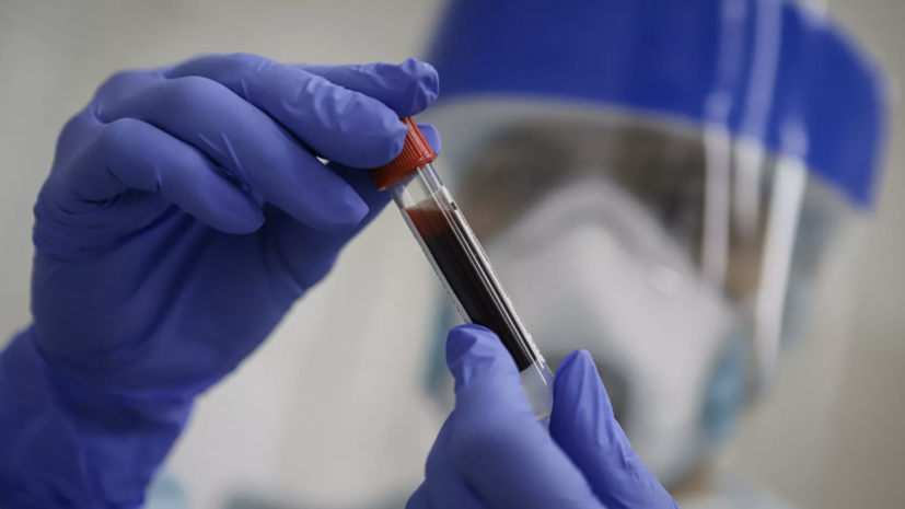 В Москве скончались ещё 23 пациента с коронавирусом