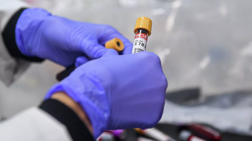 В Петербурге за сутки провели более 30 тысяч тестов на COVID-19