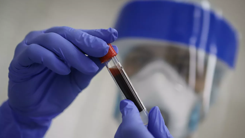 В Казахстане за сутки выявили 100 новых случаев коронавируса