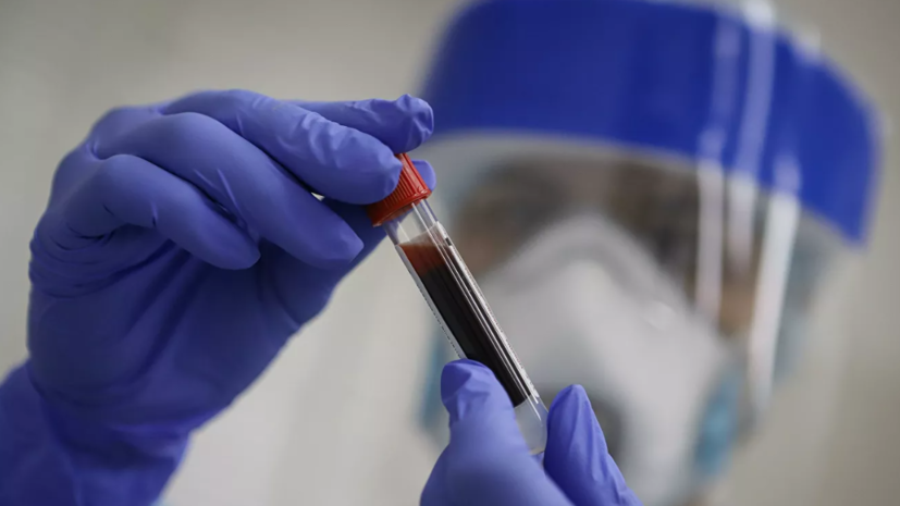 В Удмуртии за сутки выявлено 107 человек с коронавирусом