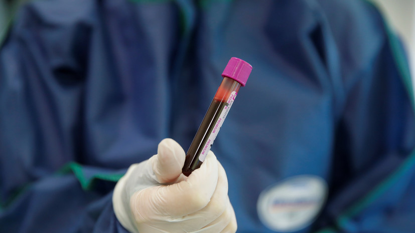 В России провели более 73 миллионов тестов на коронавирус