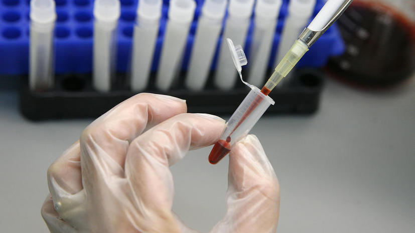 В Оренбурге пройдёт бесплатное тестирование на ВИЧ