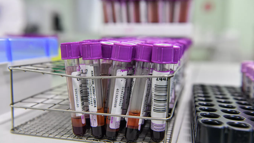 Мурашко назвал число запатентованных в России тестов на COVID-19