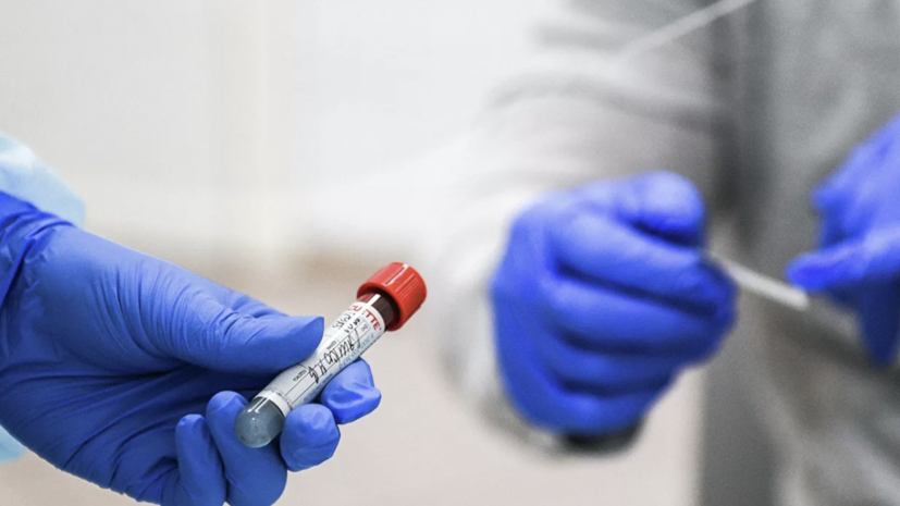 В России за сутки проведено 323 тысячи тестов на коронавирус