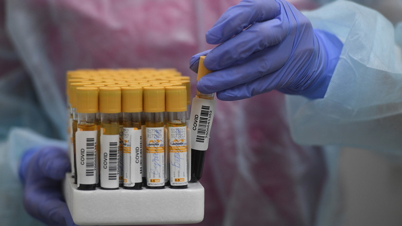 В Омской области выявили 75 случаев COVID-19 за сутки