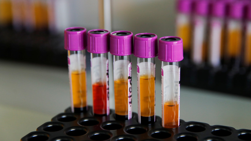 В Кировской области за сутки выявили 110 новых случаев COVID-19