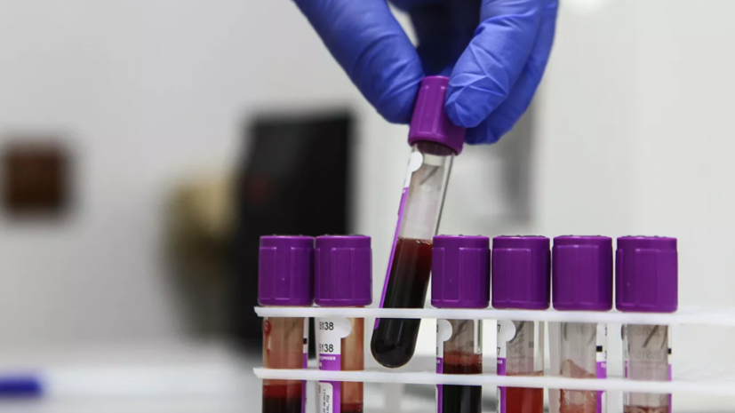В России за сутки проведено почти 400 тысяч тестов на коронавирус
