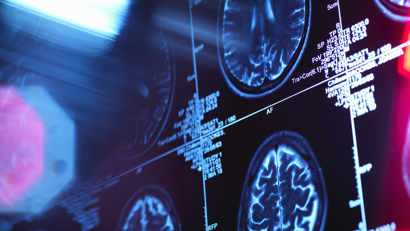 Невролог Соков рассказал о профилактике возникновения когнитивных нарушений