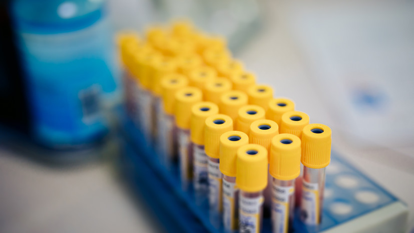 В Удмуртии выявили 295 случаев COVID-19 за сутки