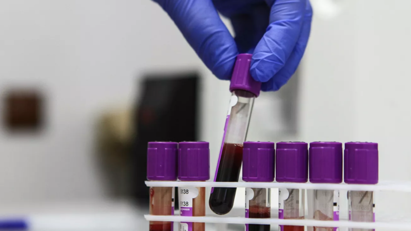 Врач Злобин рассказал о связи группы крови человека с течением COVID-19