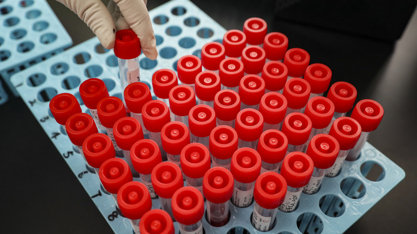 В Ростовской области зарегистрировали 571 случай коронавируса за сутки