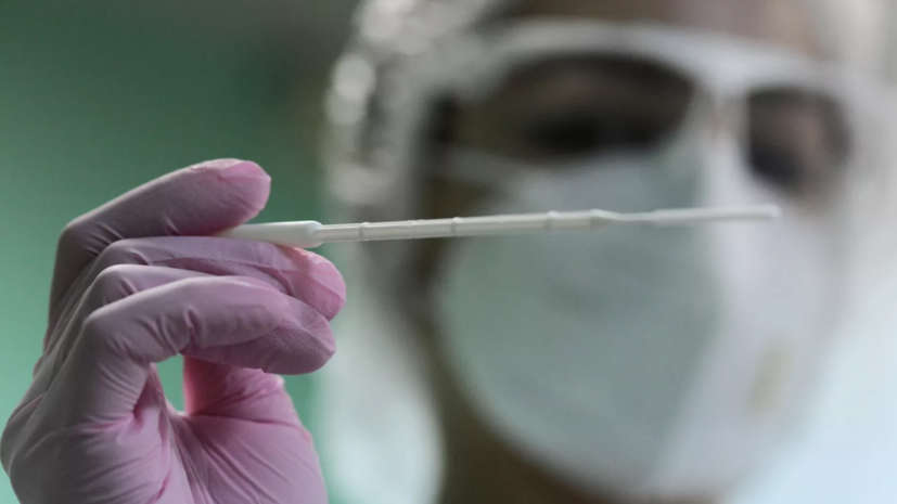В Оренбургской области зафиксировали 78 случаев COVID-19 за сутки