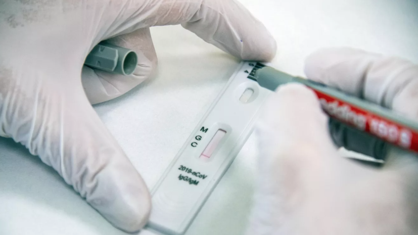 В Пермском крае подтвердили 73 случая COVID-19 за сутки