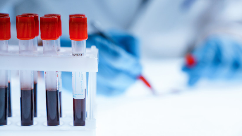 РИА Новости: выздоровевший после оспы обезьян пациент в России не представляет опасности