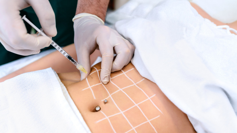 Косметолог Ованесова назвала удачный период для липосакции