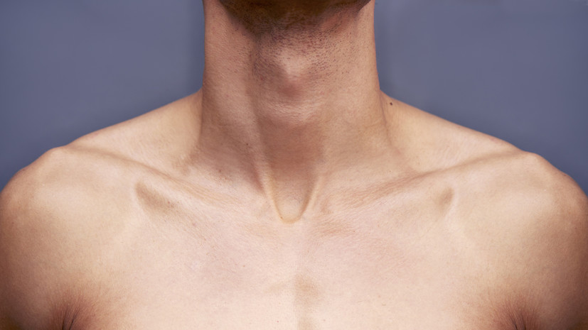 Онколог Машкова назвала ультрафиолет одним из факторов развития рака кожи