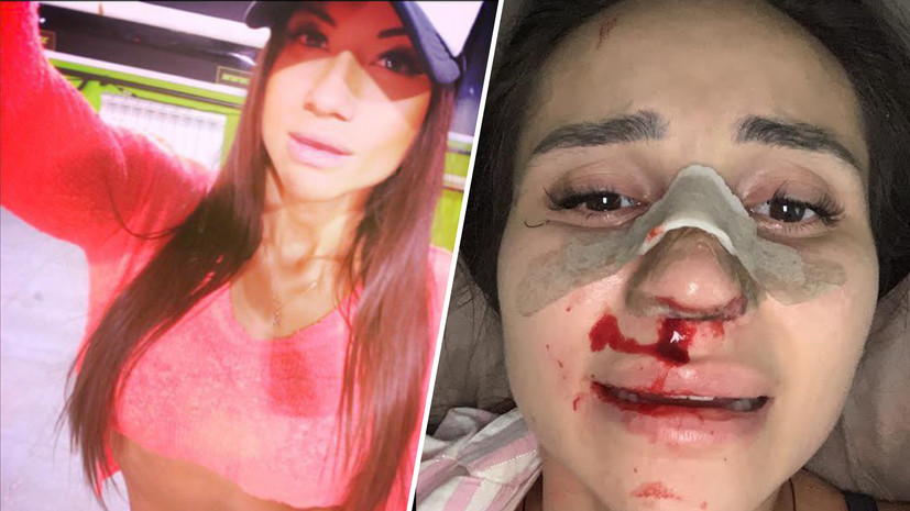 Девушка Гогричиани обратилась в полицию после избиения со стороны игрока «Балтики»