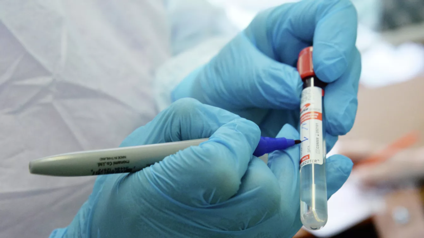 В Иркутской области выявили 53 случая коронавируса за сутки