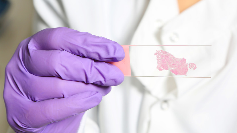 Онколог Юдин перечислил симптомы рака щитовидной железы