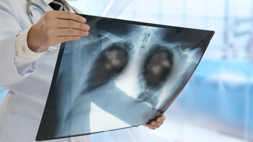 В Москве запустили пилотный проект по дистанционному мониторингу пациентов с ХОБЛ