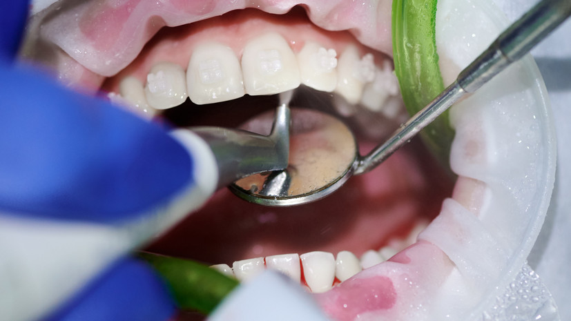 Стоматолог Елашвили посоветовал делать профессиональную чистку зубов раз в полгода