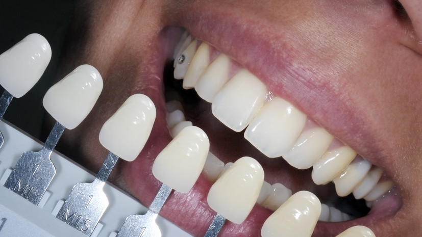 Ортодонт Калинина предостерегла от отбеливания зубов абразивными пастами