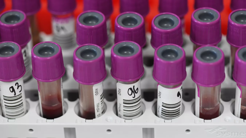 В крови скончавшейся 16-летней школьницы из Каменска-Уральского нашли кофеин