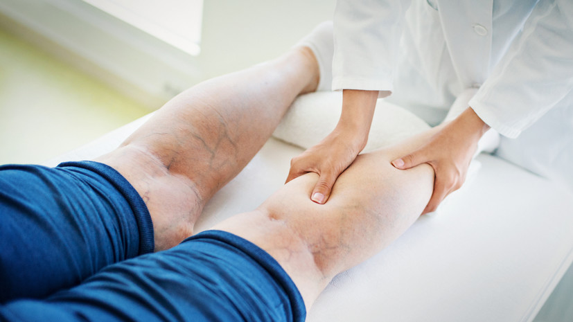 Врач Абдувосидов назвал варикоз многофакторным заболеванием