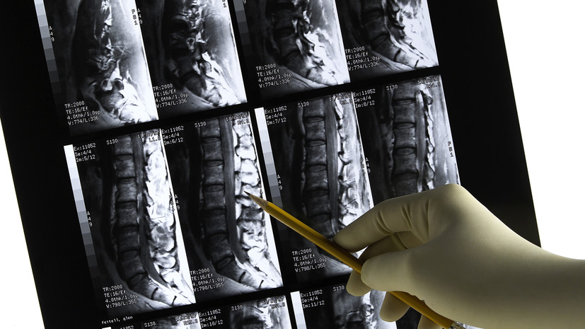 Реабилитолог Бабыдов назвал сколиоз сложным заболеванием