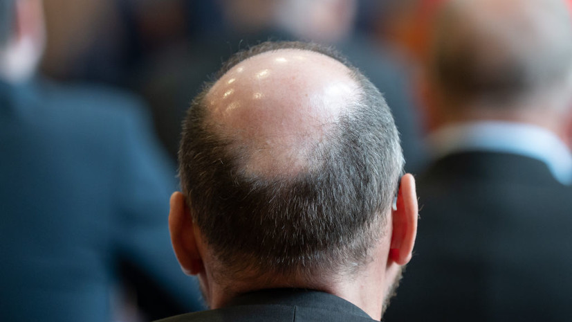 Профессор Ионов рассказал о причинах облысения у мужчин