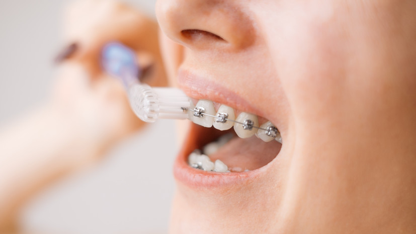 Стоматолог Давидян посоветовал использовать специальную зубную щётку для ухода за брекетами