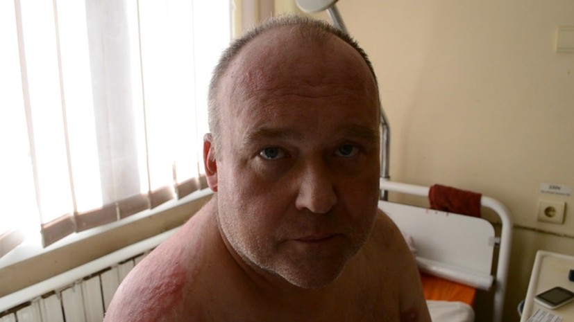 «Прилетел снаряд в машину»: Сергей Шевцов из Донецка получил ранения при артобстреле города со стороны ВСУ