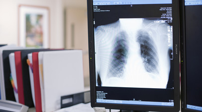 Онколог Нефёдов рассказал о симптомах болезней лёгких