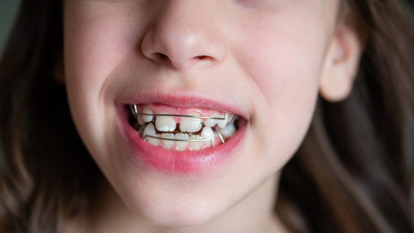 Стоматолог Балакирева: из-за неправильного прикуса может страдать позвоночник