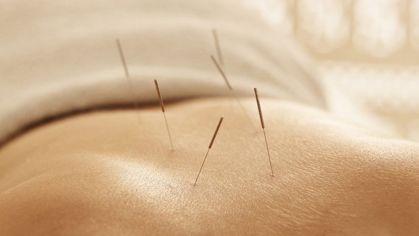 Врач Михаленко: иглоукалывание помогает при болях в мышцах