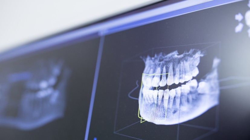 Врач Корнилина: отсутствие даже одного зуба может повлиять на челюстную систему