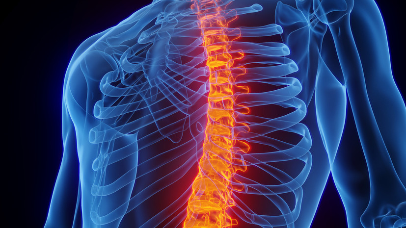 Врач Степанова: болезнь Бехтерева чаще поражает мужчин в возрасте 20—40 лет