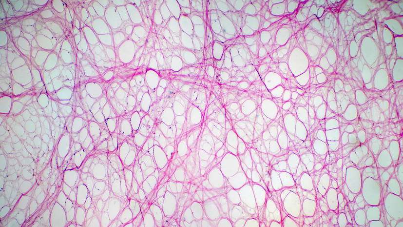 Нутрициолог Парамонова дала советы по поддержанию уровня коллагена в организме