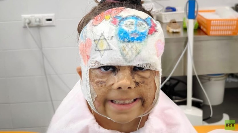 Девочке из США Луне Феннер 2 июля проведут очередную операцию в Петербурге