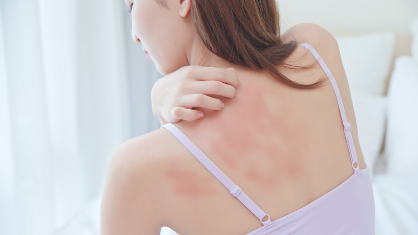 Дерматолог: церкарии могут вызвать аллергическую и воспалительную реакции