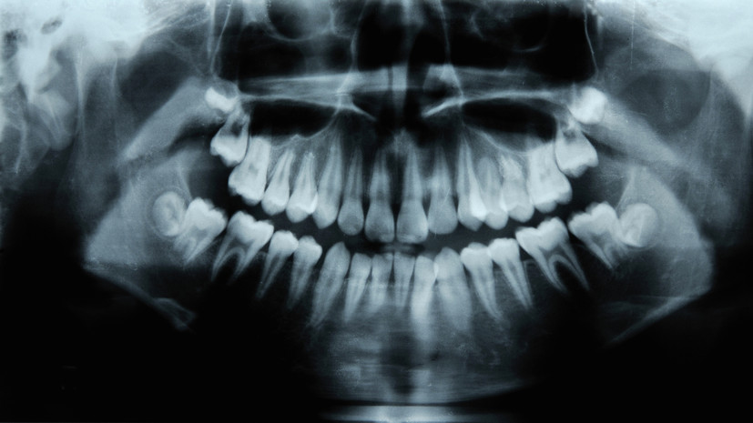 Врач Гусева: отдельная бактерия не вызовет пародонтит
