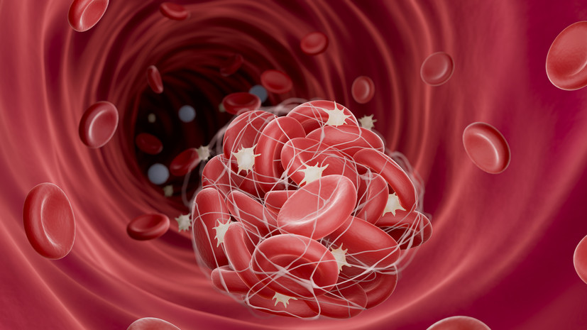 Хирург Аль-Юсеф перечислил симптомы тромбоза