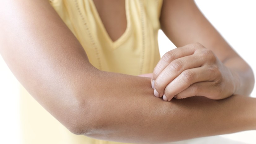 Врач Филёва: аллергия может угрожать жизни при развитии анафилактического шока