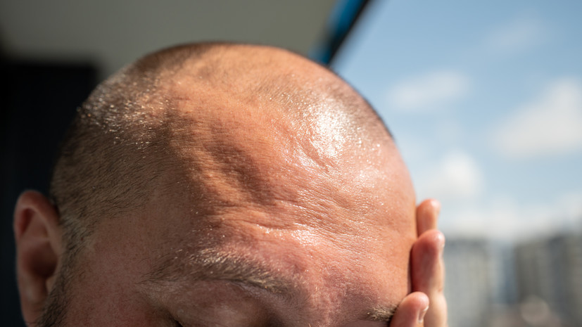 Косметолог Амосова заявила, что избыток солнца провоцирует отёки