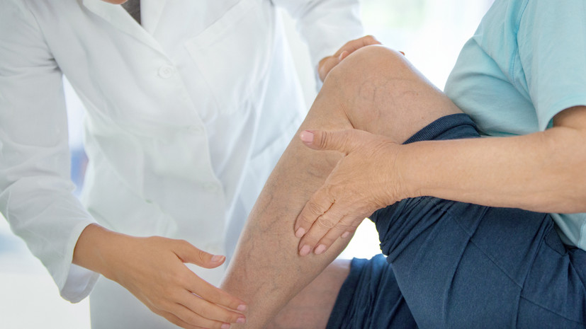 Флеболог Исаева рассказала о поддержке здоровья при варикозе