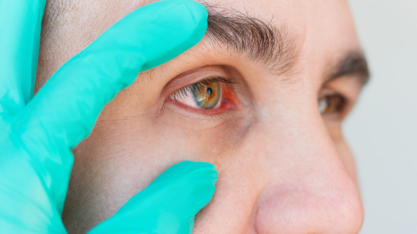 Врач Казанцев рассказал, как распознать проблемы со здоровьем по глазам