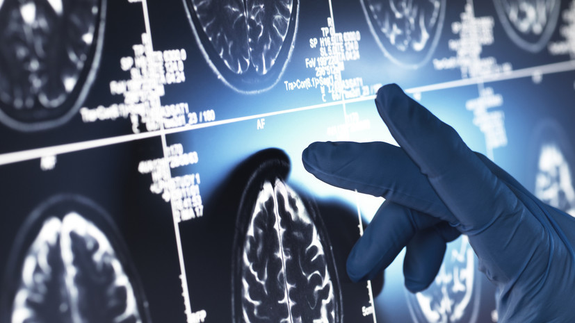 Невролог Шахнович: регулярные обследования помогут выявить деменцию на раннем этапе